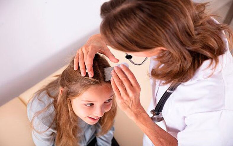 galvas psoriāzes ārstēšana bērniem